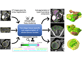 Tissue-specific and Interpretable Sub-segmentation of Whole Tumour Burden on CT Images by Unsupervised Fuzzy Clustering