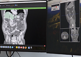 International research team receives $1 million to use AI to improve ovarian cancer care